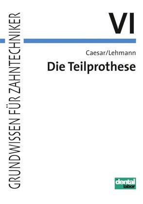 Grundwissen für Zahntechniker / Die Teilprothese von Caesar,  H Hans, Lehmann,  Klaus M.