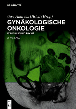 Gynäkologische Onkologie von Ulrich,  Uwe Andreas
