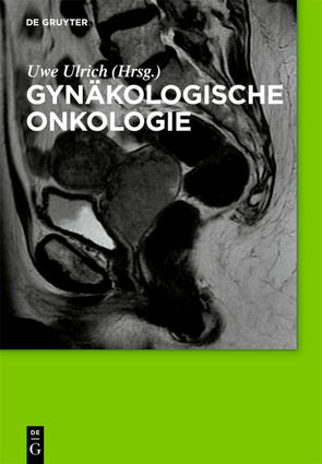 Gynäkologische Onkologie von Ulrich,  Uwe
