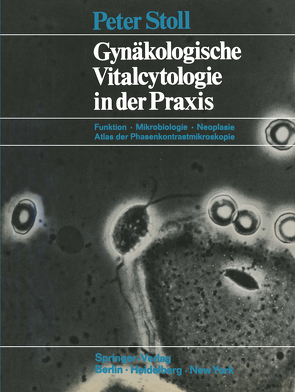 Gynäkologische Vitalcytologie in der Praxis von Dallenbach-Hellweg,  Gisela, Stoll,  Peter
