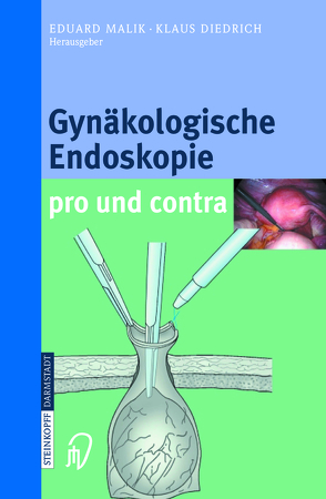 Gynäkologische Endoskopie pro und contra von Diedrich,  Klaus, Malik,  Eduard