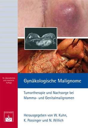 Gynäkologische Malignome von Kuhn,  W., Possinger,  K., Willich,  N.