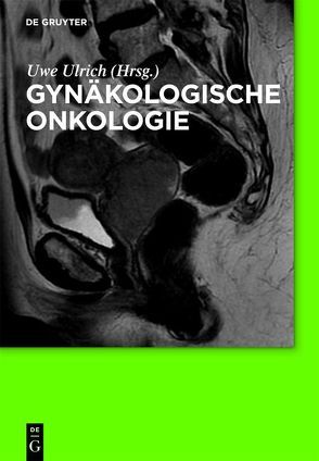 Gynäkologische Onkologie von Ulrich,  Uwe