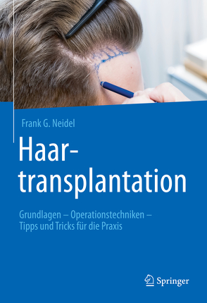 Haartransplantation von Neidel,  Frank G.
