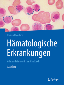 Hämatologische Erkrankungen von Haferlach,  Torsten