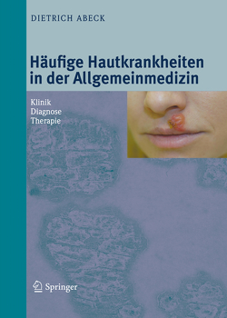 Häufige Hautkrankheiten in der Allgemeinmedizin von Abeck,  Dietrich
