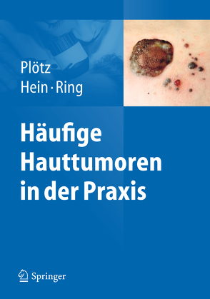 Häufige Hauttumoren in der Praxis von Hein,  Rüdiger, Plötz,  Sabine G., Ring,  Johannes
