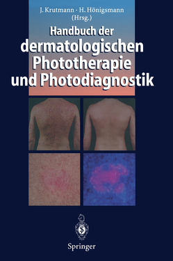 Handbuch der dermatologischen Phototherapie und Photodiagnostik von Hönigsmann,  Herbert, Krutmann,  Jean