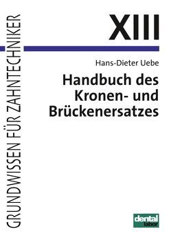 Handbuch des Kronen- und Brückenersatzes von Uebe,  Hans D
