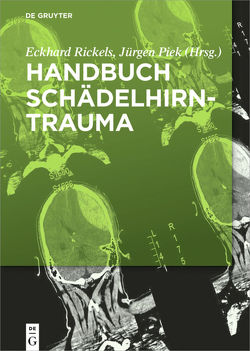 Handbuch Schädelhirntrauma von Piek,  Jürgen, Rickels,  Eckhard