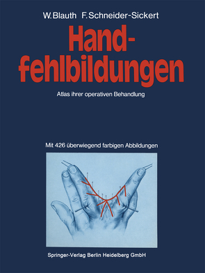 Handfehlbildungen von Blauth,  W., Schneider-Sickert,  F.