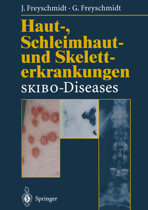 Haut-, Schleimhaut- und Skeletterkrankungen SKIBO-Diseases von Freyschmidt,  Gisela, Freyschmidt,  Jürgen