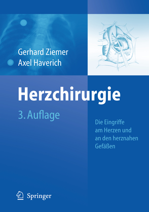 Herzchirurgie von Haverich,  Axel, Ziemer,  Gerhard