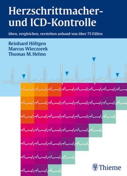 Herzschrittmacher- und ICD-Kontrolle von Helms,  Thomas M., Höltgen,  Reinhard, Wieczorek,  Marcus