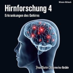 Hirnforschung 4 von Egerton,  Sofia, Frankfurter Allgemeine Archiv, Kästle,  Markus, Pessler,  Olaf