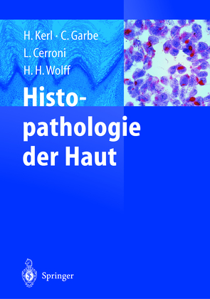 Histopathologie der Haut von Cerroni,  Lorenzo, Garbe,  Claus, Kerl,  Helmut, Wolff,  Helmut