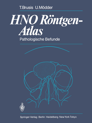 HNO Röntgen-Atlas von Brusis,  Tilman, Friedmann,  G., Mödder,  Ulrich