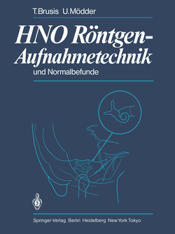 HNO Röntgen-Aufnahmetechnik und Normalbefunde von Brusis,  T., Mödder,  U.