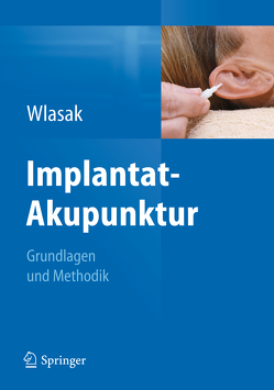 Implantat-Akupunktur von Wlasak,  Rolf