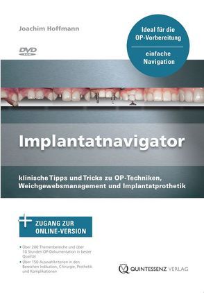 Implantatnavigator von Hoffmann,  Joachim