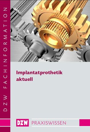 Implantatprothetik aktuell von ZahnarztWoche,  Die