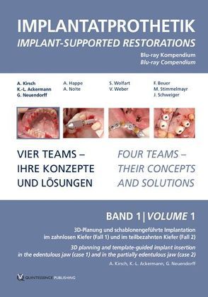 Implantatprothetik Band 1 von Ackermann,  Karl-Ludwig, Kirsch,  Axel, Neuendorff,  Gerhard