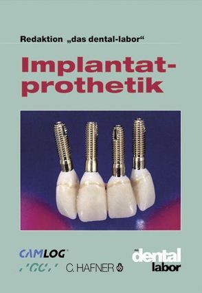Implantatprothetik von Verlag Neuer Merkur GmbH