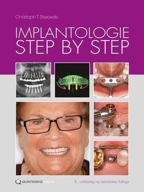 Implantologie Step by Step von Hümmeke,  Stefan, Sliwowska,  Dominika, Sliwowski,  Christoph T., Stappert,  Christian F. J.