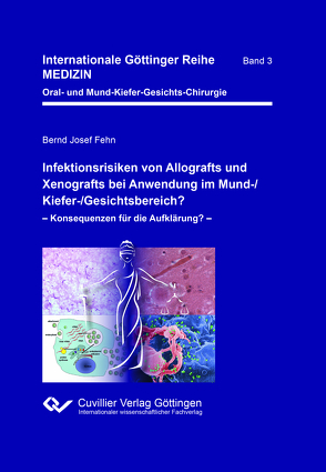 Infektionsrisiken von Allografts und Xenografts bei Anwendung im Mund-/Kiefer-/Gesichtsbereich? von Fehn,  Bernd Josef