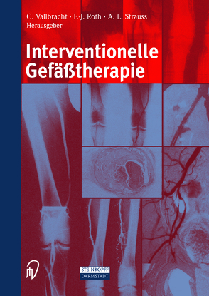 Interventionelle Gefäßtherapie von Kaltenbach,  M., Roth,  F.-J., Schoop,  W., Strauss,  A.L., Vallbracht,  C.
