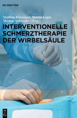 Interventionelle Schmerztherapie der Wirbelsäule von Klessinger,  Stephan, Legat,  Martin, Schneider,  Markus