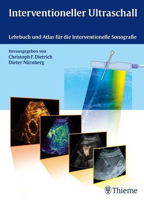Interventioneller Ultraschall von Dietrich,  Christoph Frank, Nürnberg,  Dieter