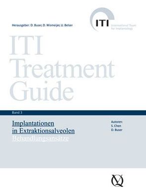Implantationen in Extraktionsalveolen von Belser,  Urs, Buser,  Daniel, Wismeijer,  Daniel