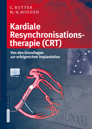 Kardiale Resynchronisationstherapie (CRT) von Butter,  Christian, Minden,  Hans-Heinrich