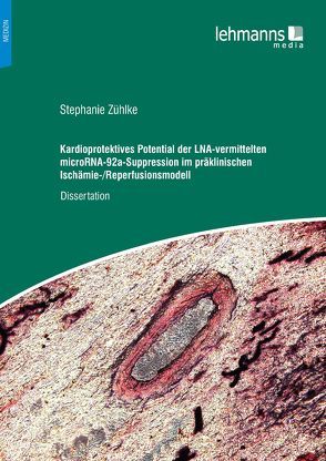 Kardioprotektives Potential der LNA-vermittelten microRNA-92a-Suppression im präklinischen Ischämie-/Reperfusionsmodell von Zühlke,  Stephanie