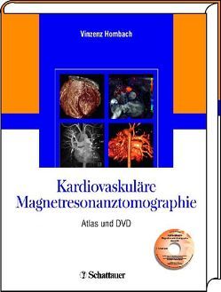 Kardiovaskuläre Magnetresonanztomographie von Hombach,  Vinzenz