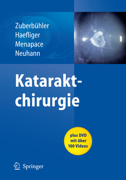 Kataraktchirurgie von Haefliger,  E., Menapace,  Rupert, Neuhann,  Thomas, Zuberbuhler,  Bruno