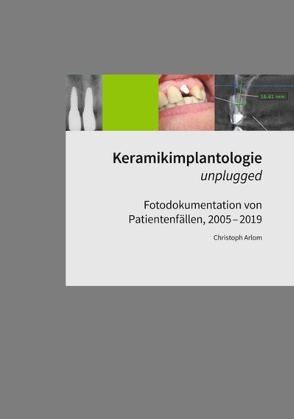 Keramikimplantologie unplugged von Arlom,  Christoph