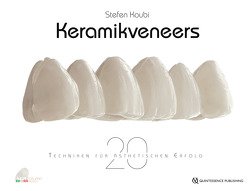 Keramikveneers von Koubi,  Stefen