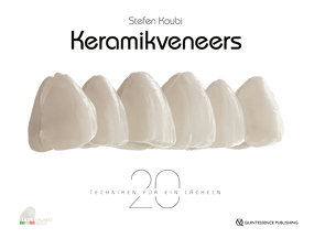 Keramikveneers von Koubi,  Stefen