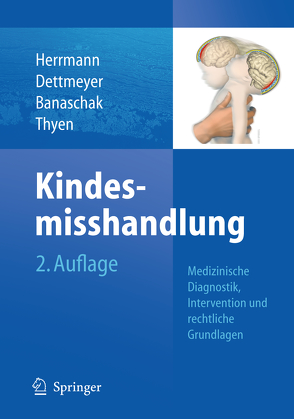 Kindesmisshandlung von Banaschak,  Sibylle, Dettmeyer,  Reinhard B., Herrmann,  Bernd, Thyen,  Ute