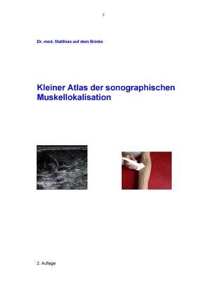 Kleiner Atlas der sonographischen Muskellokalisation von Brinke,  Dr. med. Matthias auf dem