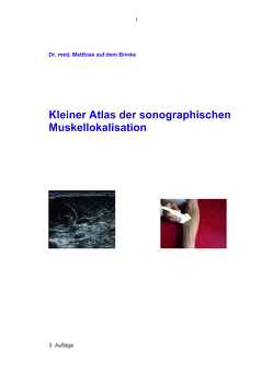 Kleiner Atlas der sonographischen Muskellokalisation von auf dem Brinke,  Matthias
