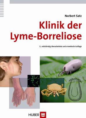 Klinik der Lyme-Borreliose von Satz,  Norbert