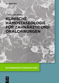 Klinische Hämostaseologie für Zahnärzte und Oralchirurgen von Schüttler-Janikulla,  Claus, Sucker,  Christoph