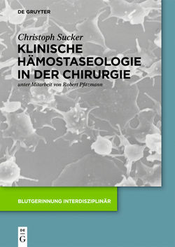 Klinische Hämostaseologie in der Chirurgie von Pfitzmann,  Robert, Sucker,  Christoph