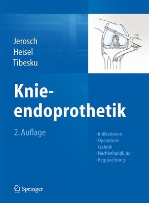 Knieendoprothetik von Heisel,  Jürgen, Jerosch,  Jörg, Matziolis,  Georg, Tibesku,  Carsten O.