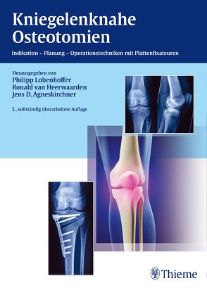 Kniegelenknahe Osteotomien von Agneskirchner,  Jens, Lobenhoffer,  Philipp, van Heerwaarden,  Ronald