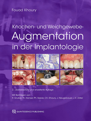 Knochen- und Weichgewebeaugmentation in der Implantologie von Khoury,  Fouad