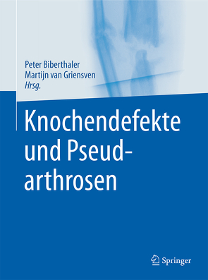 Knochendefekte und Pseudarthrosen von Biberthaler,  Peter, van Griensven,  Martijn